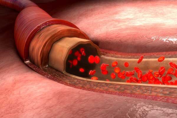 The Best Ways to Increase Blood Flow to Your Penis